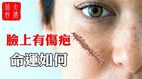 女人額頭有疤的運程圖